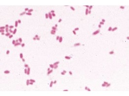 Escherichia coli  colibacilles  frottis