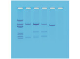 SIMULATION DE TEST DE PATERNITE PAR ADN- EDVOTEK -114
