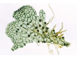 Fern prothallium  selected to show antheridia and archegonia w.m.  