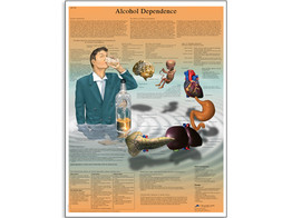 ALCOHOL DEPENDENCE CHART - VR1792L  1001620 