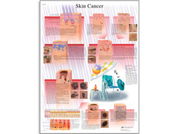 SKIN CANCER CHART - VR1295L  1001514 