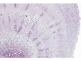 Beta  beet  t.s. of a superterrestrial storage root