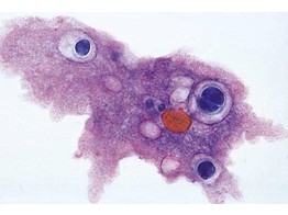 Amoeba proteus  Amoben  Zellkern  Ekto- und Endoplasma  Nahrungsvakuolen  Pseudopodien