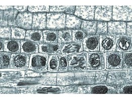 ROOT TIPS OF ALLIUM CEPA L.S. SHOWING CELL DIVISION  MITOSIS  IN ALL STAGES  CLEARLY STAINED