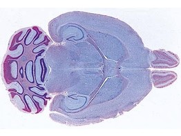 Brain of mouse  horizontal l.s. of the complete organ