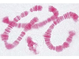 Riesenchromosomen aus der Speicheldruse der Chironomuslarve  Quetschpraparat  Spezialfarbung