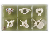 COLLECTION CASE  VERTEBRAE AND SPINAL CORD 