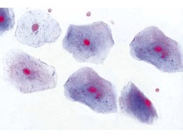 Squamous epithelium  isolated cells from human mouth  smear