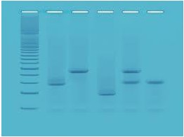 DNA FINGERPRINTING MET PCR