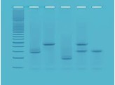 DNA FINGERPRINTING MET PCR