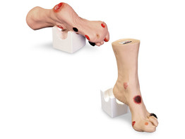 FOOT MODEL  WILMA  WITH 18 INJURIES