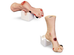 MODELE DE PIED  WILMA  AVEC 18 BLESSURES