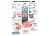 UNDERSTANDING ASTHMA POSTER