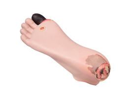 DECUBITUS VOETMODEL -  P14
