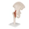 FUNCTIONAL HIP JOINT- A81  1000161 