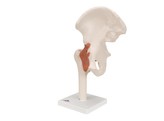 FUNCTIONAL HIP JOINT- A81  1000161 