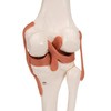 FUNCTIONAL KNEE JOINT - br/  A82  1000163 