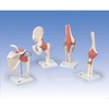 DELUXE FUNCTIONAL ELBOW JOINT MODEL br/  -  A83/1  1000166 