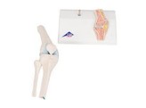  br/ MINI KNEE JOINT WITH CROSS SECTION - A 85/1  1000170 