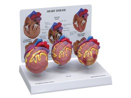 3-MINI HEART MODEL SET br/  W33365 