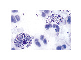 PATHOGENIC BACTERIA