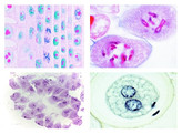 SERIES OF 6 SLIDES - MITOSIS AND MEIOSIS SET I -W13456