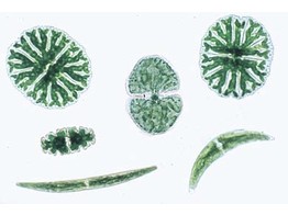 Desmidiales  melange de plusieurs especes
