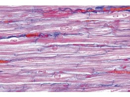 Heart  cardiac  muscle  human l.s. and t.s.