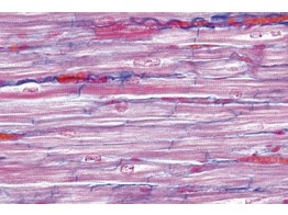 Muscle cardiaque de l homme c.l. et c.t.