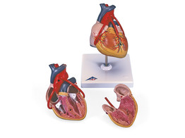 CLASSIC HEART WITH BYPASS  2 PART  G05  1000262 