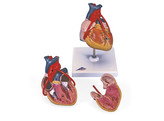 CLASSIC HEART WITH BYPASS  2 PART  G05  1000262 