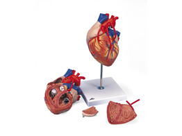 HEART WITH BYPASS  2 TIMES LIFE SIZE  4 PART   G06  1000263 
