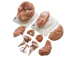 BRAIN WITH ARTERIES  9 PARTS