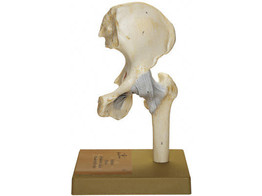 HIP JOINT