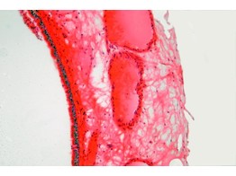 TRILHAAREPITHEEL LUCHTP.KONIJN - SH.1080A