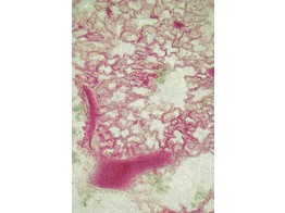 Lunge mit injizierten Blutgefassen  Kaninchen  c.s. - SH.1110A