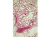 Lunge mit injizierten Blutgefassen  Kaninchen  c.s. - SH.1110A