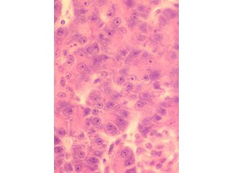 PANCREAS DE LAPIN  COUPE  COUPE - SH.1140A