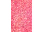 Lymphknoten  Kaninchen  c.s. - SH.1160A