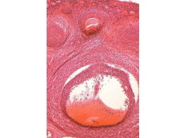 Ovary rabbit with developed eggs - SH.1340A