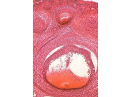 OVAIRE DE LAPIN  C.T. AVEC DEVELOPPEMENT DES FOLLICULES - SH.1340A