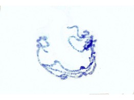 Drosophila  chromosomes geants  glande salivaire - SZ.1724B