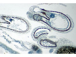 Shephards purse  ovary embryo in cotyledon stadium  l.s. - SB.2222A