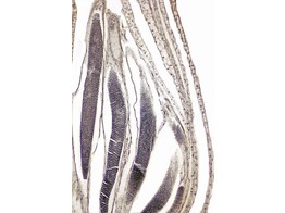 Mnie  Mnium  antheridies  coupe longitudinal - SB.2337A