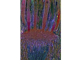 Mnie  Mnium  archegonus  coupe longitudinal - SB.2339A