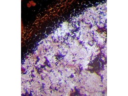 BACILLUS SUBTILIS  FROTTIS - SB.2415