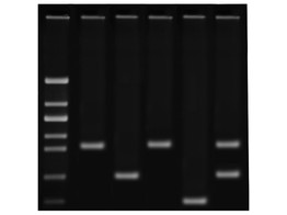 NACHWEIS VON COVID-19 MITTELS REVERSE-TRANSKRIPTIONS-PCR  RT-PCR 