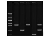 NACHWEIS VON COVID-19 MITTELS REVERSE-TRANSKRIPTIONS-PCR  RT-PCR 