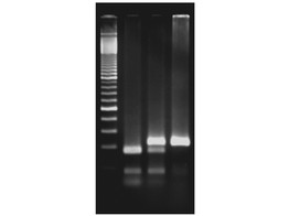EXPLORING THE GENETICS OF TASTE  SNP ANALYSIS OF THE PTC GENE USING PCR