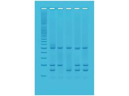 IDENTIFIZIERUNG VON GENTECHNISCH VERANDERTEN LEBENSMITTELN MITTELS PCR